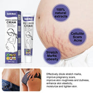 Crema Minune pentru Vergeturi