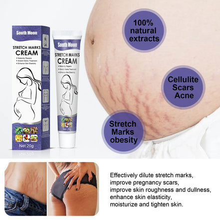 Crema Minune pentru Vergeturi